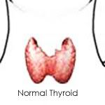 normal_thyroid.jpg image by xokizzyxo